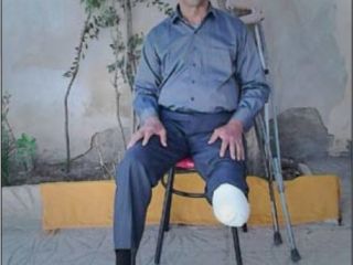 روایت معلمی که پایش را در سرما از دست داد و مسوولانی که می‌گویند متاسفیم آقای اسدزاده!