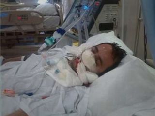 کما به خاطر جراحی بینی