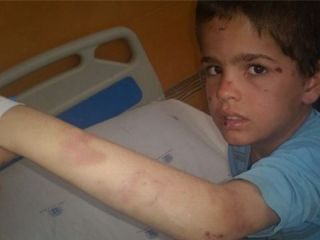 گفته‌های ضد و نقیض درباره «دستور معلم» برای «کتک زدن» یک دانش‌آموز