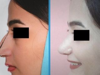 تفریح مردم ایران با عمل جراحی زیبایی