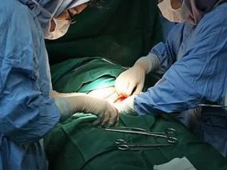 سزارین نکردند بچه با ایدز به دنیا آمد