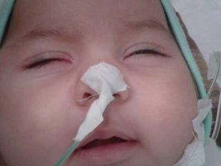 زندگی نباتی امیر عباس ۵ ماهه اتفاق یا قصور پزشکی