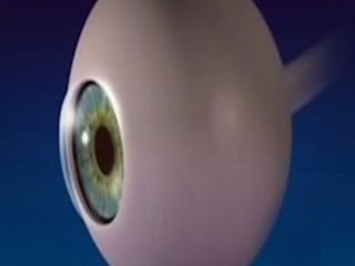 برای اولین بار در جهان نابینایی با ترمیم شبکیه چشم در ایران درمان می شود