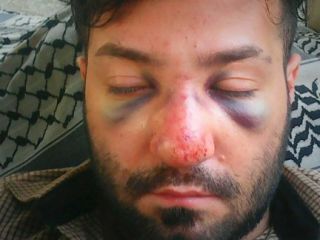 مرگ جوان تهرانی در بازداشتگاه پلیس بر اثر عواقب ضرب‌وشتم +تصاویر