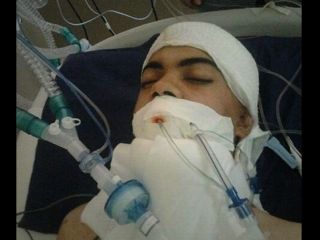 پایان زندگی آخرین سرباز مصدوم حادثه نی‌ریز با اهدای اعضای سالم بدنش