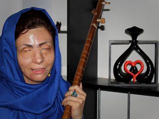 قربانی اسید پاشی: کسی که روی من اسید پاشید، در مدرسه دارد درس می دهد