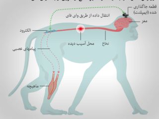 روشی که بیمار قطع نخاعی را می‌تواند مداوا ‌کند