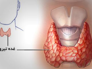 وقتی بدن به غده تیروئید حمله می کند