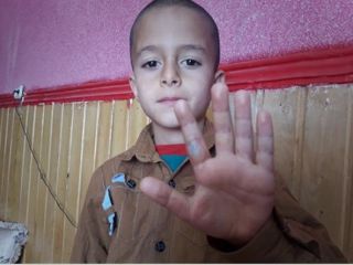 معلم بی رحم شاگرد کلاس اول را با خط کش داغ تنببه کرد