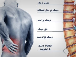 دلایل و درمان‌های کمردرد