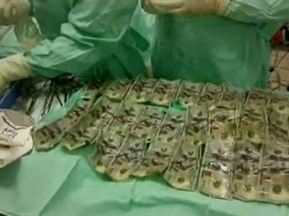 زنی از ترس همسرش ۷ هزار دلار را بلعید