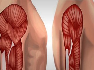 کم ماهیچگی؛ بیماری مرتبط با سن