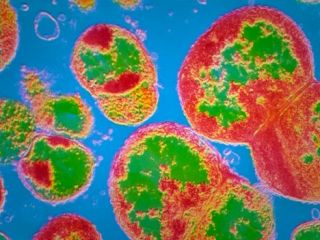 سازمان بهداشت جهانی در مورد سوزاک مقاوم به آنتی‌بیوتیک هشدار داد