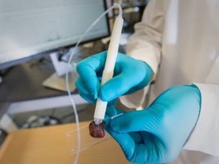 'قلمی' که در ده ثانیه سرطان را تشخیص می‌دهد