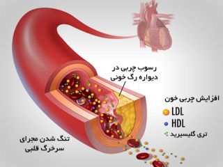 علل افزایش چربی خون