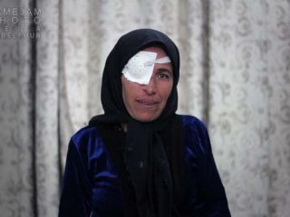 خرچنگ، چشم راست پری را خورده است