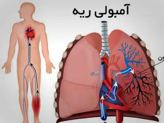 چرا خون یکدفعه لخته می‌شود؟