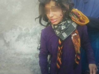 جزئیات شکنجه ۳ کودک در ماهشهر با چکش و میله داغ / شکستگی بدن و دندان ها / پدر بازداشت شد (+فیلم و عکس لحظه نجات کودکان)