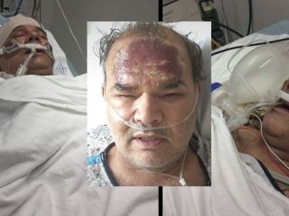 منصور اسانلو بر اثر یک حمله مشکوک همچنان در بیمارستانی در نیویورک بستری است