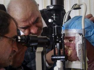 پرونده اسیدپاشی‌های اصفهان مختومه اعلام شد