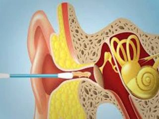 از تمیز کردن گوش بپرهیزید!