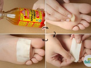 ترفندهای خانگی برای رفع پینه