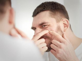 ۵ غذا برای دفاع از پوست در مقابل آکنه