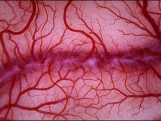 سه خوراکی که باید برای پیشگیری از گرفتگی رگ‌های قلب بخورید