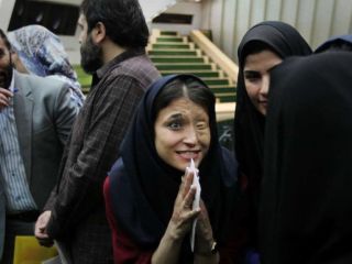 نماینده مجلس به قربانی اسیدپاشی اصفهان : قِسِر در رفتی که فقط یک طرف صورتت آسیب دید