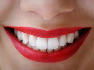 سفید کردن دندان ها در منزل با روشهای ساده و ارزان