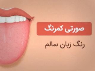 رنگ زبان در مورد وضعیت سلامتی تان چه می گوید؟