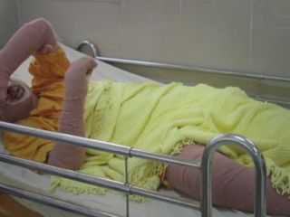 «دختر آبی » که در مقابل دادسرا خودسوزی کرده بود ، درگذشت