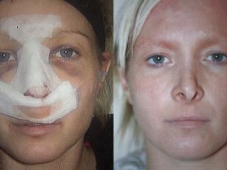 جراحی زیبایی خراب شد، «دکترم فرار کرد»