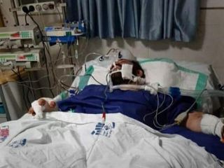 زنده بیرون آمدن هانی کُرده از زیر عمل جراحی ۱۲ ساعته - ویدیو