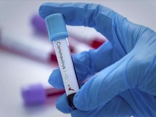 ابتلای ۴ فرد دیگر به کرونا در قطر...همگی در ایران مسافر بودند