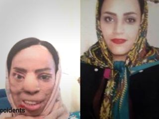 درخواست زنی که متهم به اسیدپاشی روی خواهرشوهرش است