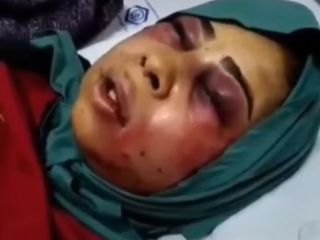 کتک زدن وحشتناک زن توسط شوهرش به خاطر بستری کردن او در کمپ ترک اعتیاد