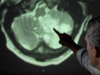 کرونا چه بر سر مغز می‌آورد؟