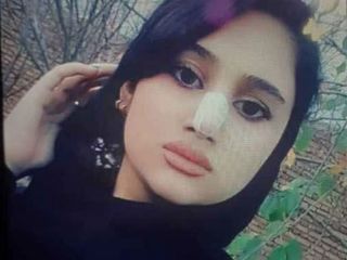 نجات ۴ بیمار با اعضای بدن دختر ۱۶‌ساله ای که خودکشی کرده بود