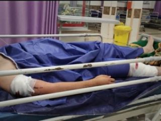 ۲۱ضربه چاقو به عکاس آژانس عکس تهران برای سرقت وسایلش