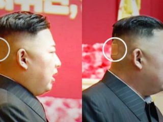 ماجرای چسب زخم پشت سر «کیم جون اون» چیست؟