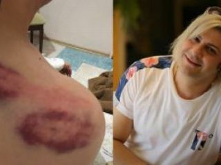 پناهنده رنگین‌کمانی ایرانی در ترکیه مورد ضرب و جرح شدید قرار گرفت