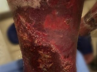 تصویری تکاندهنده و وحشتناک از وضعیت سلامت یک زندانی سیاسی