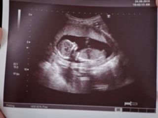 هشدار درباره به راه افتادن موج بیماری ایدز در ایران با طرح جوانی جمعیت