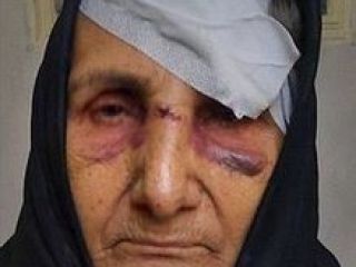 اولین تصاویر منتشر شده از گوهر عشقی(مادر ستار بهشتی) پس از حمله به او