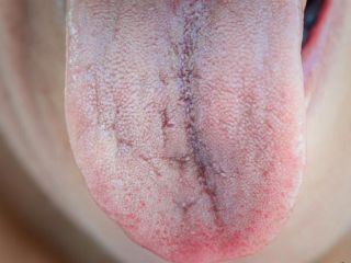 بیماری‌هایی که در زبان شما نهفته‌اند