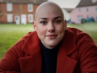 دختری که سالهاست کلاه گیس می گذارد: پس از جنجال اسکار کلاه گیسم را دور می اندازم