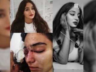 پرسش یک قربانی از ضارب حکومتی‌اش: چرا وقت شلیک «لبخند بر لبانت بود؟»