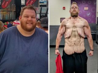 وایرال شدن تصاویری از کاهش وزن ۱۵۰ کیلوگرم یک مرد در شبکه های اجتماعی