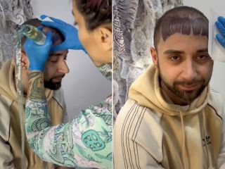 رویای جوان ایتالیایی برای پوشاندن طاسی سرش با تتو به کابوس تبدیل شد
